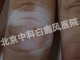 ҽԺ