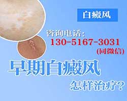 白癜风怎么能治好